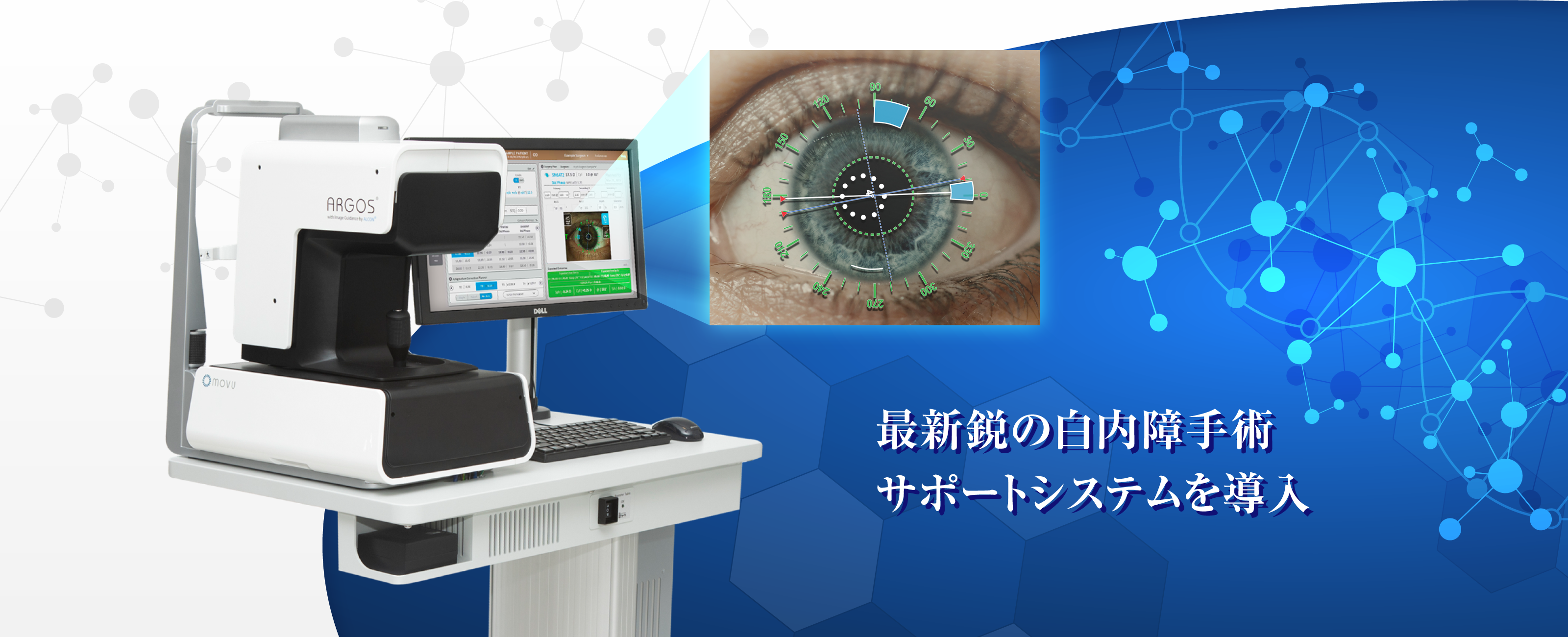 最新鋭の白内障手術サポートシステムを導入