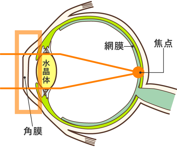 昼:レンズをはずした後