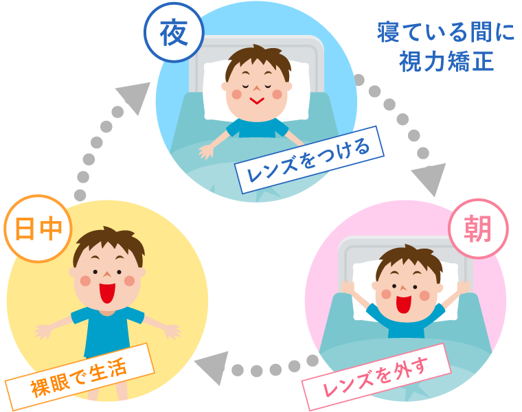 オルソケラトロジーレンズの使用方法