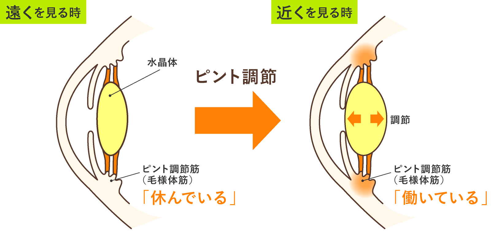 近視